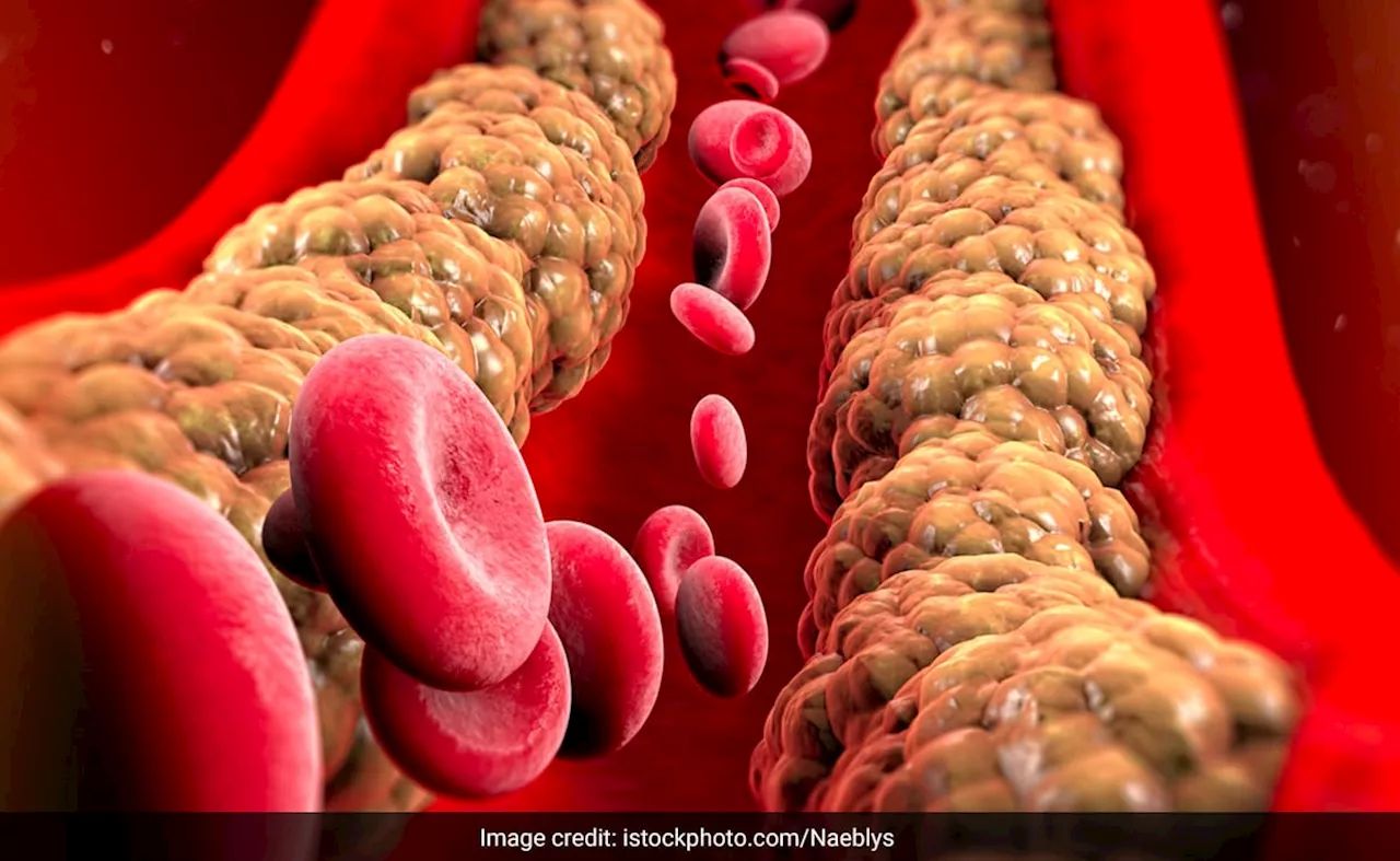 हाई कोलेस्ट्रॉल के मरीजों का कोलेस्ट्रॉल लेवल कितना होता है? जानिए नॉर्मल Cholesterol Level कितना होना चाहिए