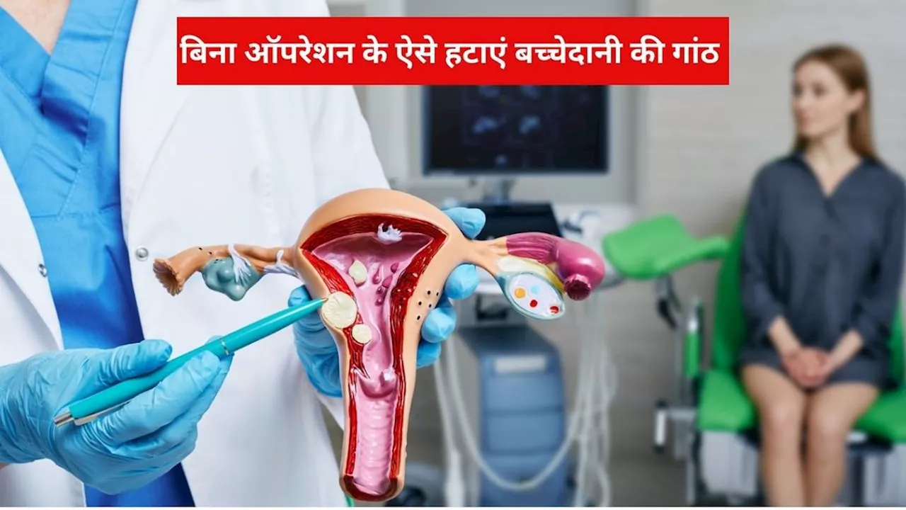 Fibroids treatment: बच्चेदानी की गांठ हटाने के लिए नहीं पड़ेगी ऑपरेशन की जरूरत, आयुर्वेद में हर्ब से इलाज संभव