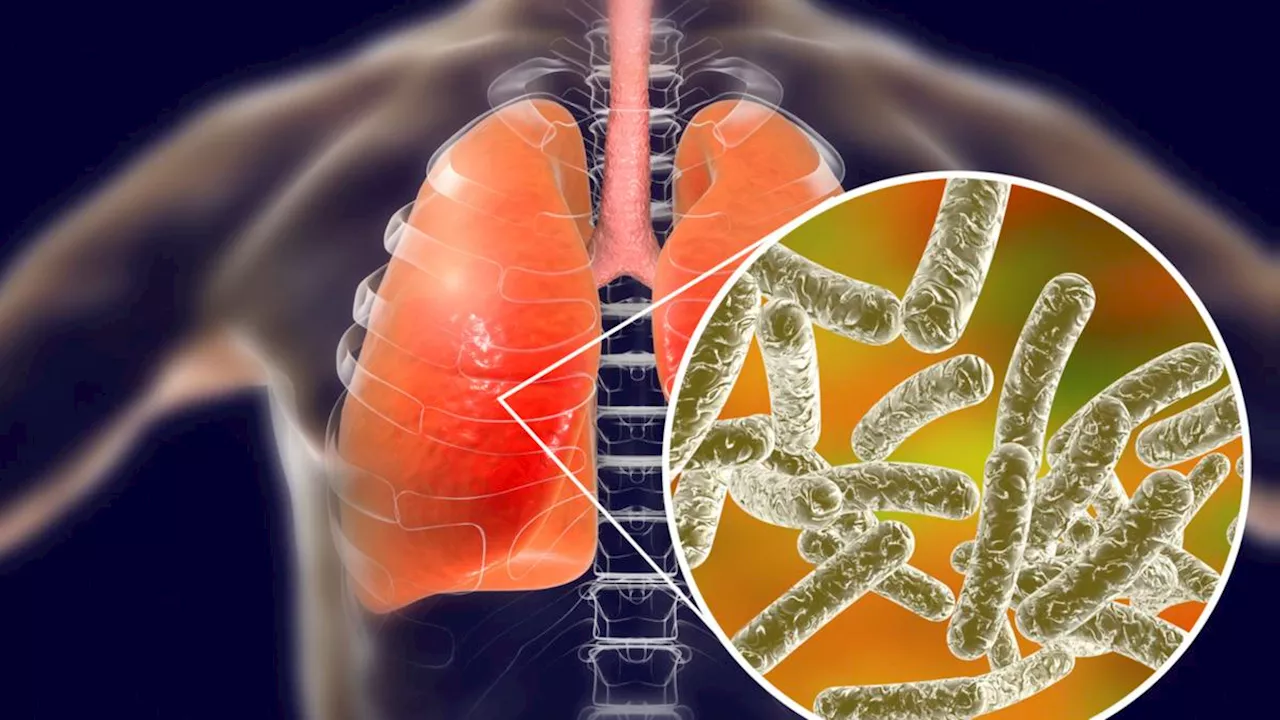 Health warning as more than a dozen people hospitalised with Legionnaires’ disease