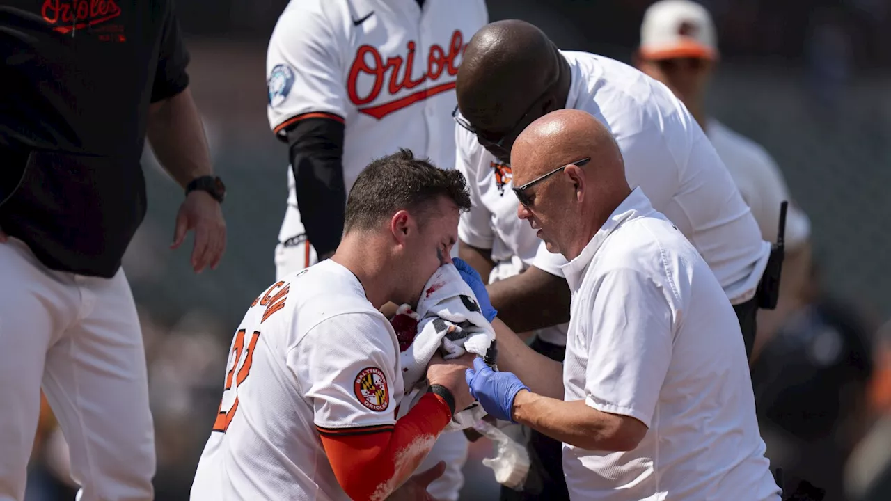 Orioles catcher James McCann shrugs off fastball to face, stays in game after being bloodied