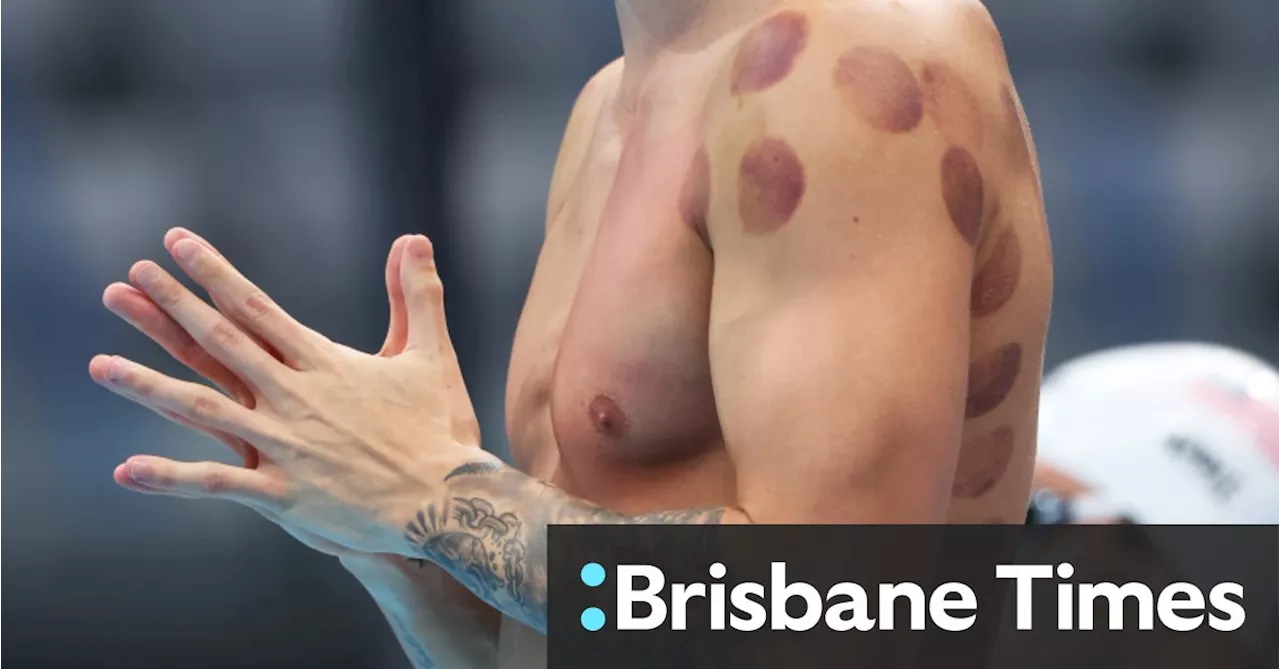 What are those red dots on Kyle Chalmers’ back?