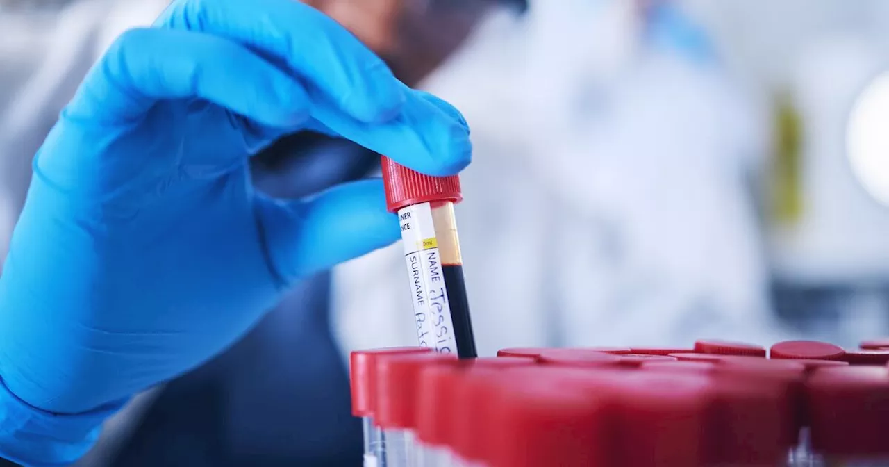 Blood test accurately diagnoses Alzheimer’s 90% of the time