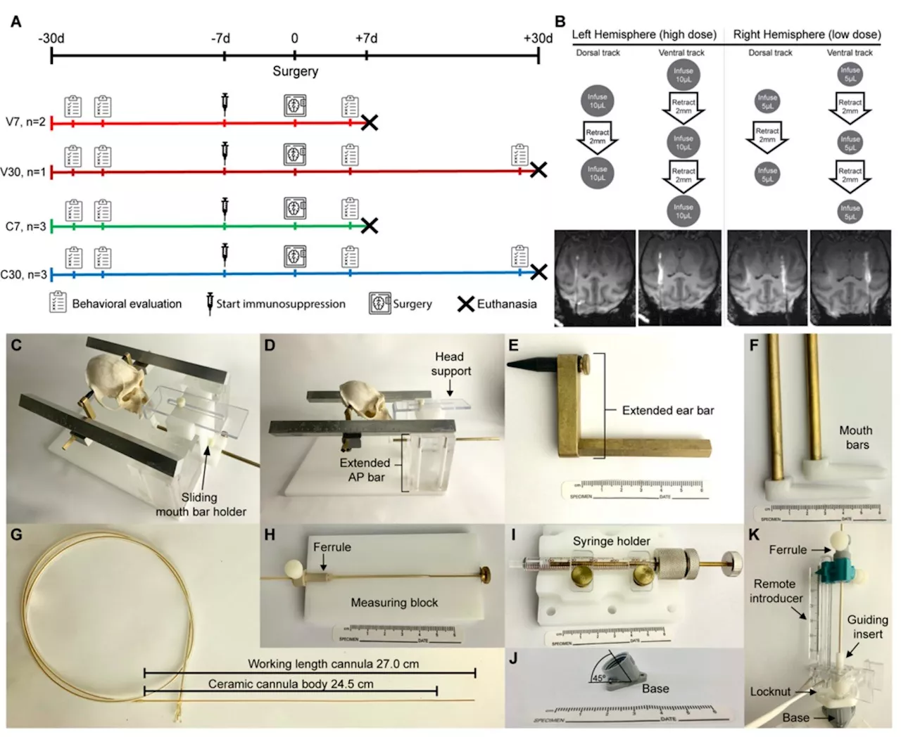 Brain cell grafts in monkeys jump-start human trial for new Parkinson's treatment