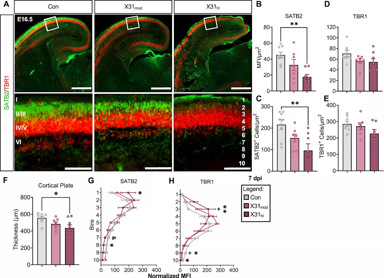 Fetal brain impacted when mom fights severe flu: New mouse study explains how