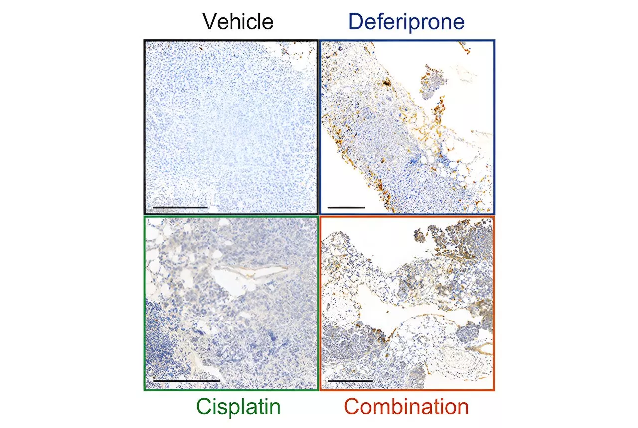 Preclinical study explores approved drug for ovarian cancer