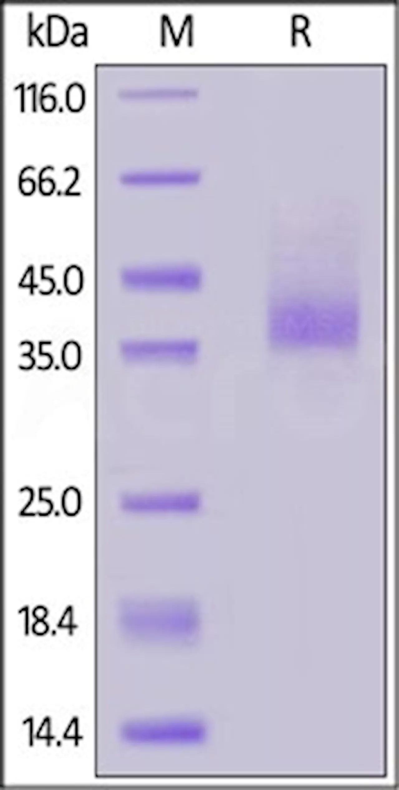 C-X-C motif chemokine receptor 4 (CXCR4)