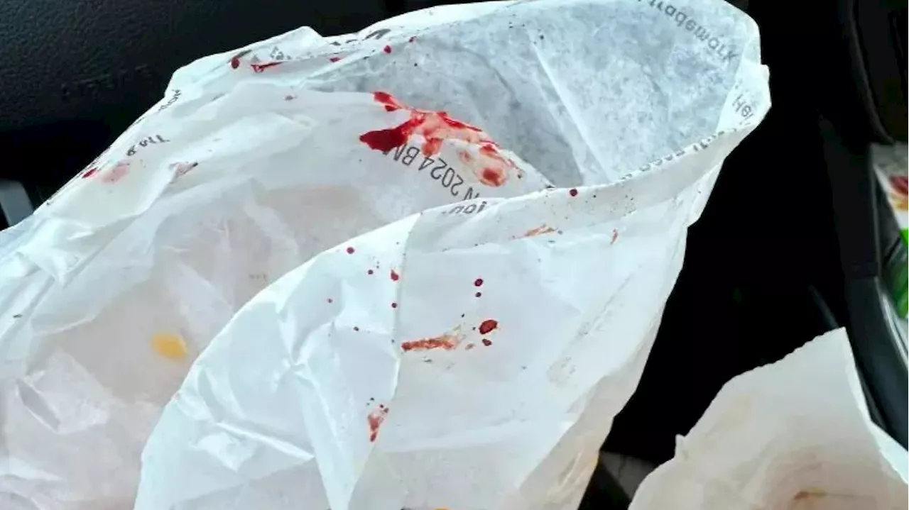 New York: Ekel-Alarm bei Burger King! Tochter beißt in Blut-Burger