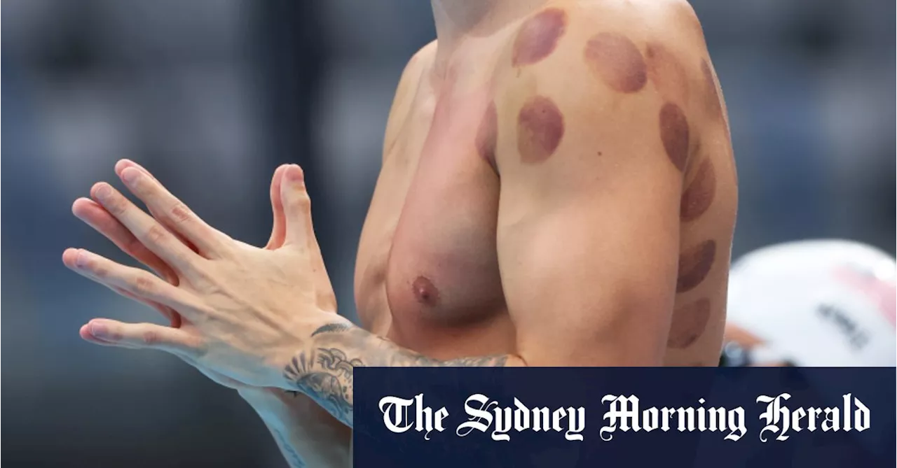 What are those red dots on Kyle Chalmers’ back?