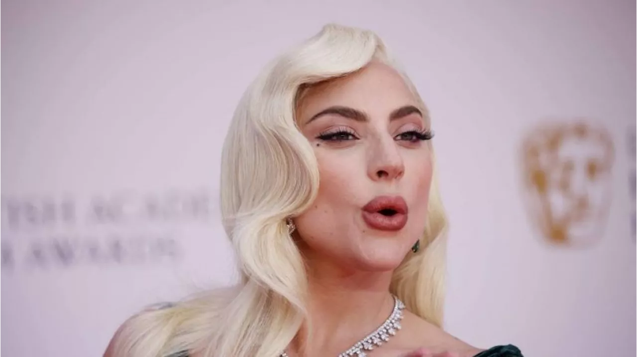 Tunangan dengan Pengusaha Tajir, Kekayaan Lady Gaga Cuma Separuhnya