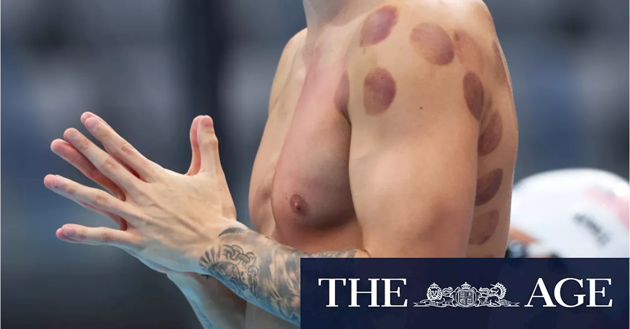 What are those red dots on Kyle Chalmers’ back?