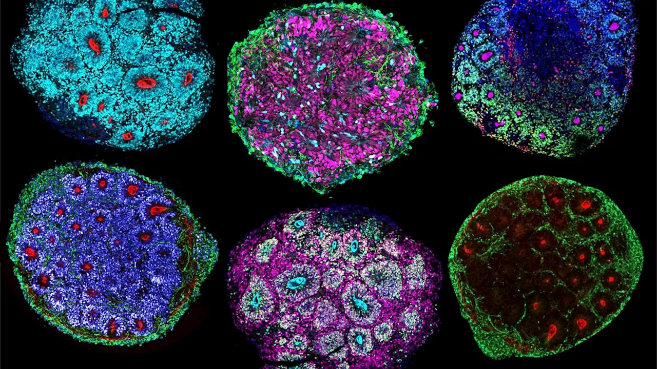 Scientists just grew the 1st-ever 'minibrains' from multiple people's cells