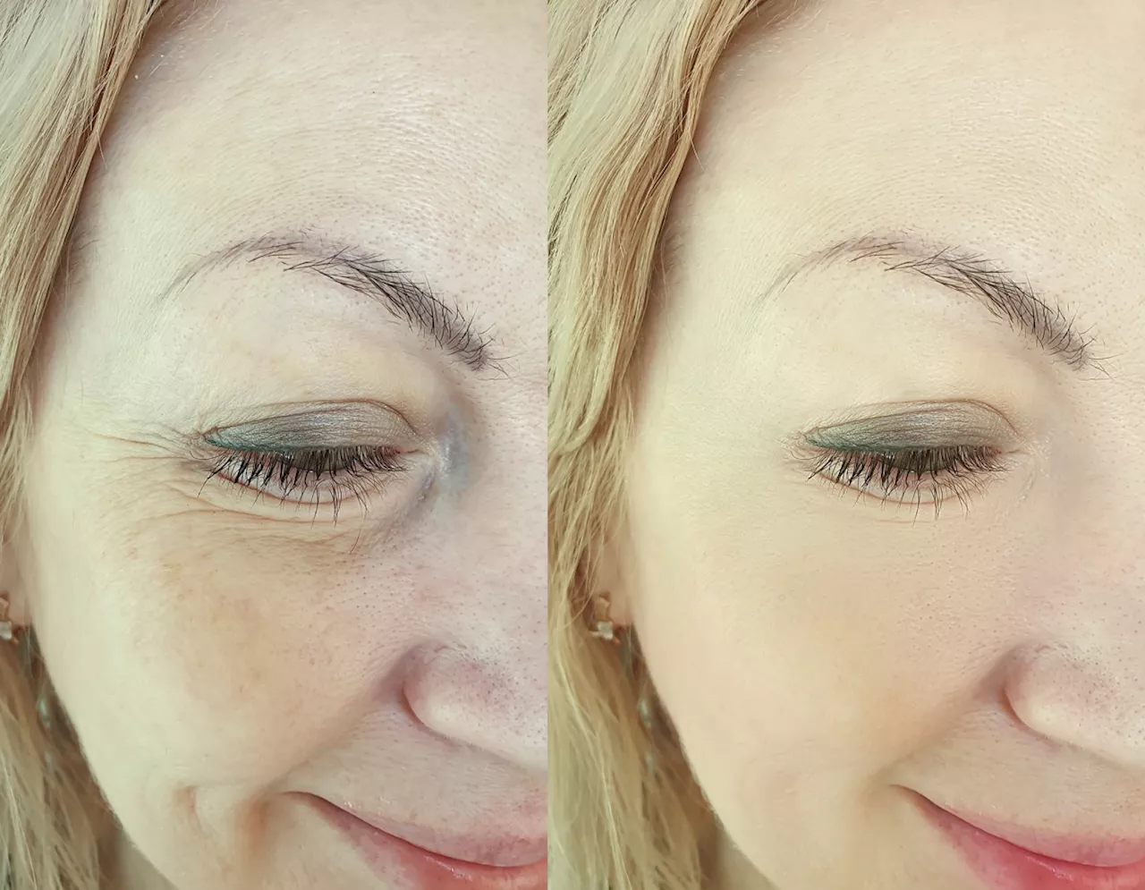 This $35 Eye Cream Lifts and Tightens Your Eyes