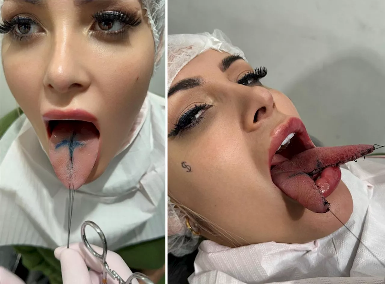 Imagens fortes: Andressa Urach faz procedimento de 'língua de cobra' em busca de 'maior prazer'; vídeo