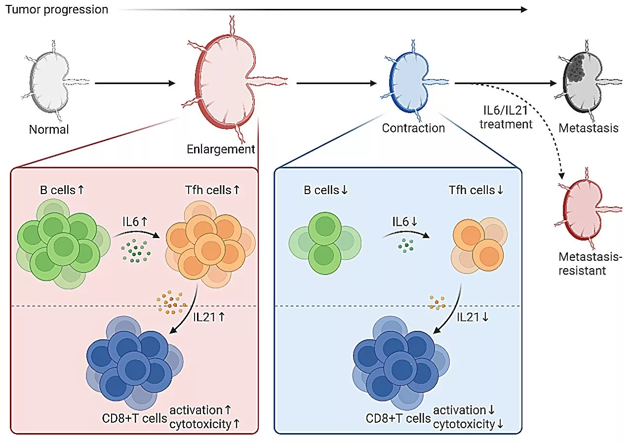 New therapeutic strategies raised to prevent and resist metastasis in lymph nodes of breast cancer
