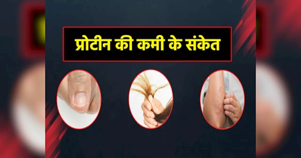 Protein Deficiency: शरीर में 6 बदलाव देते हैं प्रोटीन की कमी के संकेत, तुरंत डाइट में शामिल कर लें ये फूड्स