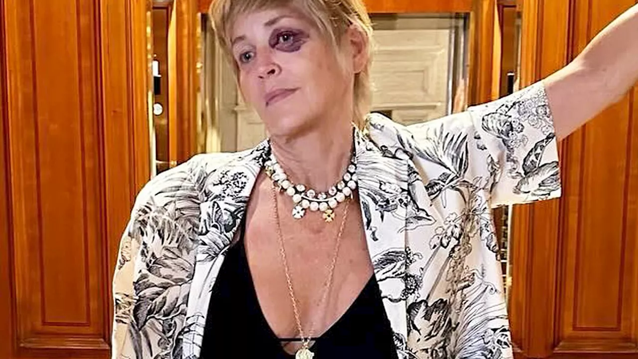 Sharon Stone, 66, appears to have suffered a BLACK EYE during vacation: 'This trip has been tough;...