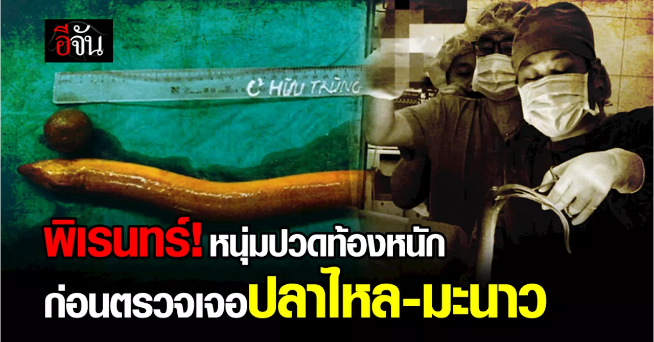 หนุ่มวัย 31 ปี ปวดท้องหนัก ก่อนเจอปลาไหลในท้อง มะนาวในทวาร