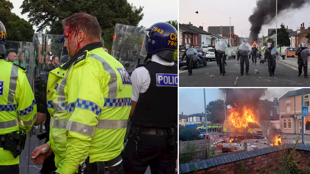 Police officers ‘lost teeth’ and ‘had ankles broken’ in Southport riots, says chairman of Merseyside Police...