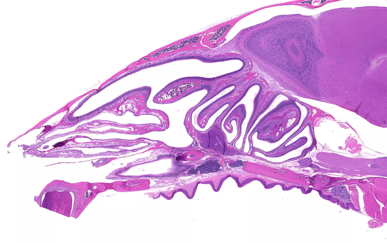 Finding immune cells under our very noses: Antibody-producing cells discovered inside the nasal conchae