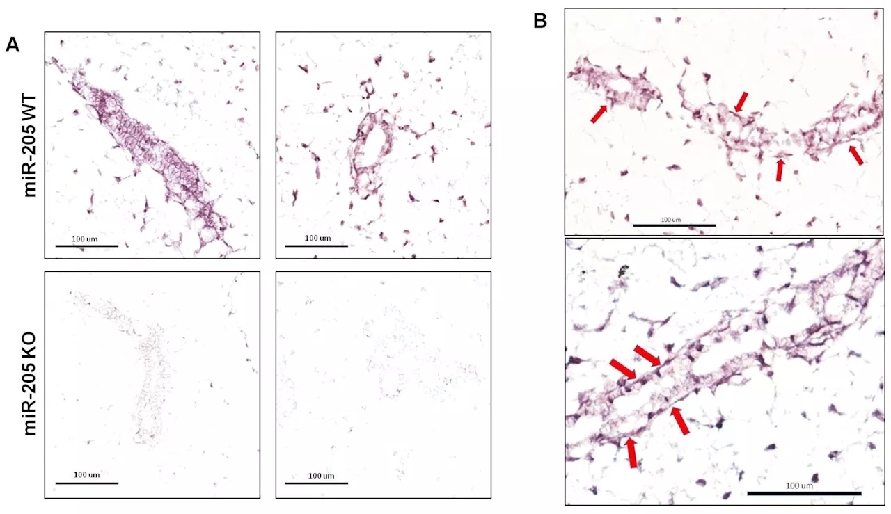 Genetic loss of miR-205 boosts mammary gland development in mice, reveals new insights into breast cancer suppression