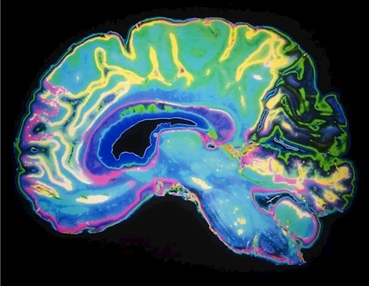 High-resolution brain maps reveal vascular blueprint for healthy aging