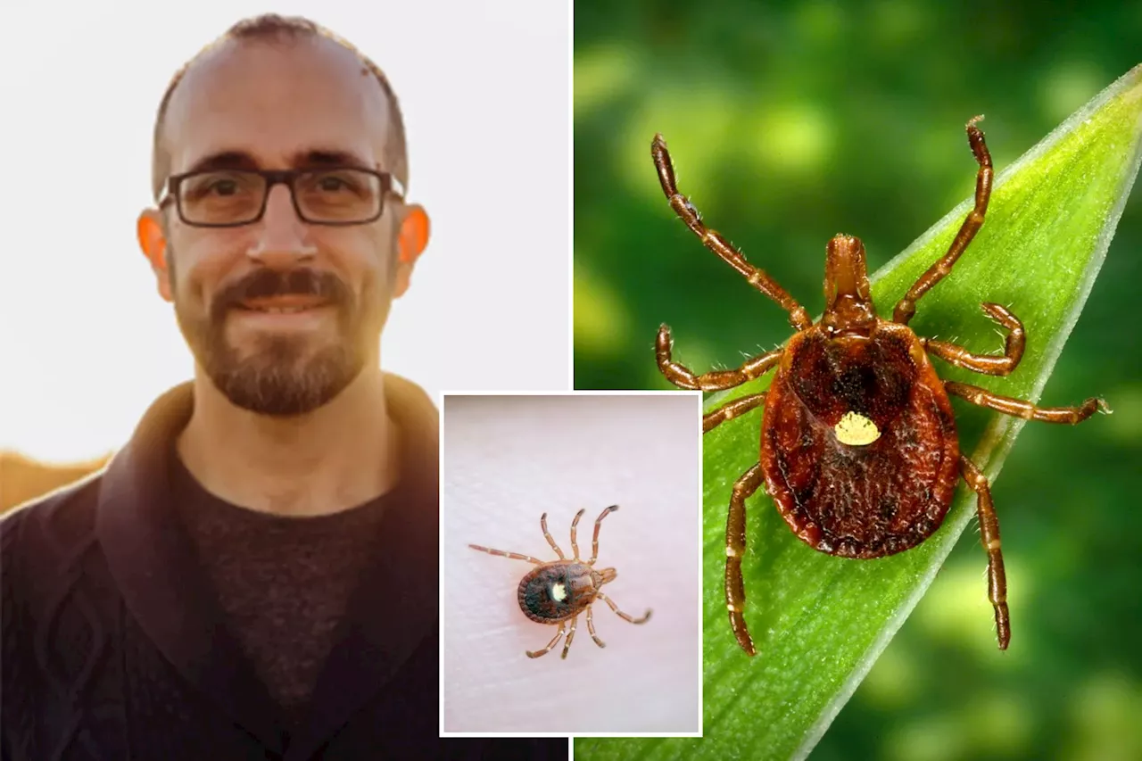 Tick bite to blame after Kansas professor suffers near-fatal allergic reaction to barbecue sandwich