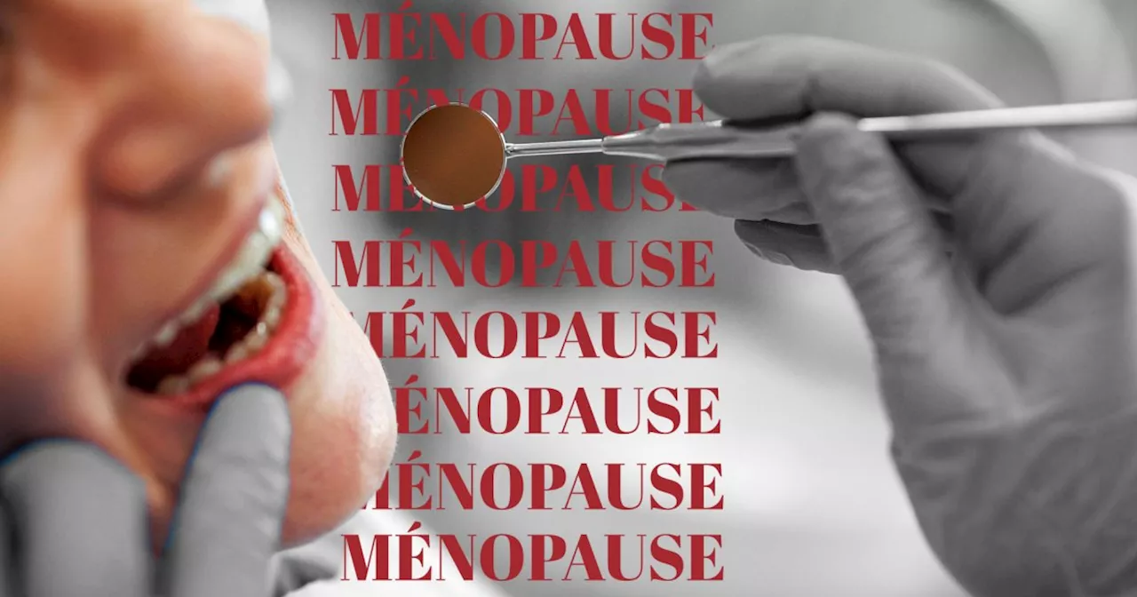 Ces symptômes dentaires seraient des signes méconnus de la ménopause