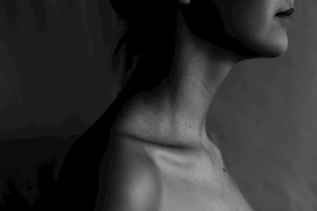 Genomic variants study points to improved detection of thyroid cancer