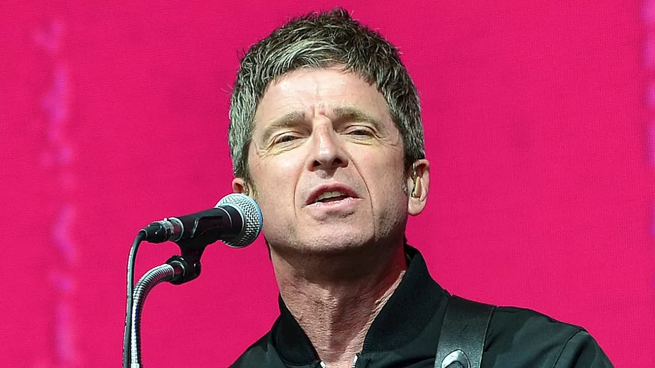 Noel Gallagher, 57, 'set to undergo surgery for a knee replacement after being hit by arthritis' -...