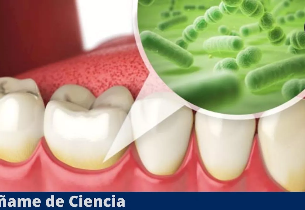 Placa dentobacteriana, sarro o caries: Cómo se forma cada uno y cuál es peor