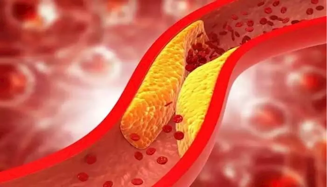 Cholesterol Signs: మీ కాళ్లలో ఈ లక్షణాలు కన్పిస్తే జాగ్రత్త, కొలెస్ట్రాల్ ప్రమాదకర స్థాయిలో ఉన్నట్టే