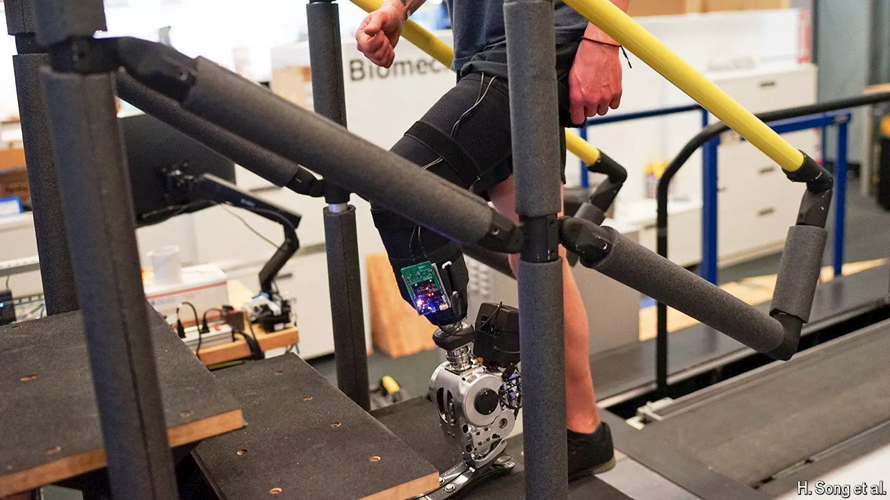 A new bionic leg can be controlled by the brain alone