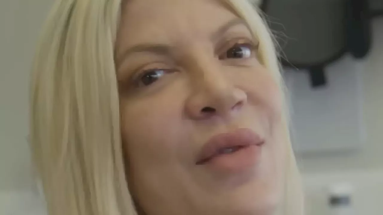 Tori Spelling gives fans an inside look into her veneer procedure - and reveals how her new teeth...