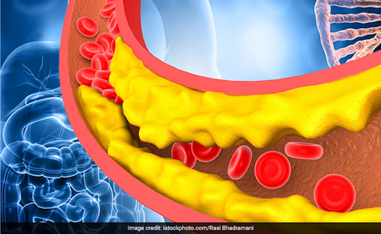 बहुत ज्यादा बढ़ने लगा है कोलेस्ट्रॉल, तो तुरंत अपना लें ये 6 तरीके, कुछ ही दिन में होने लगेगा कंट्रोल