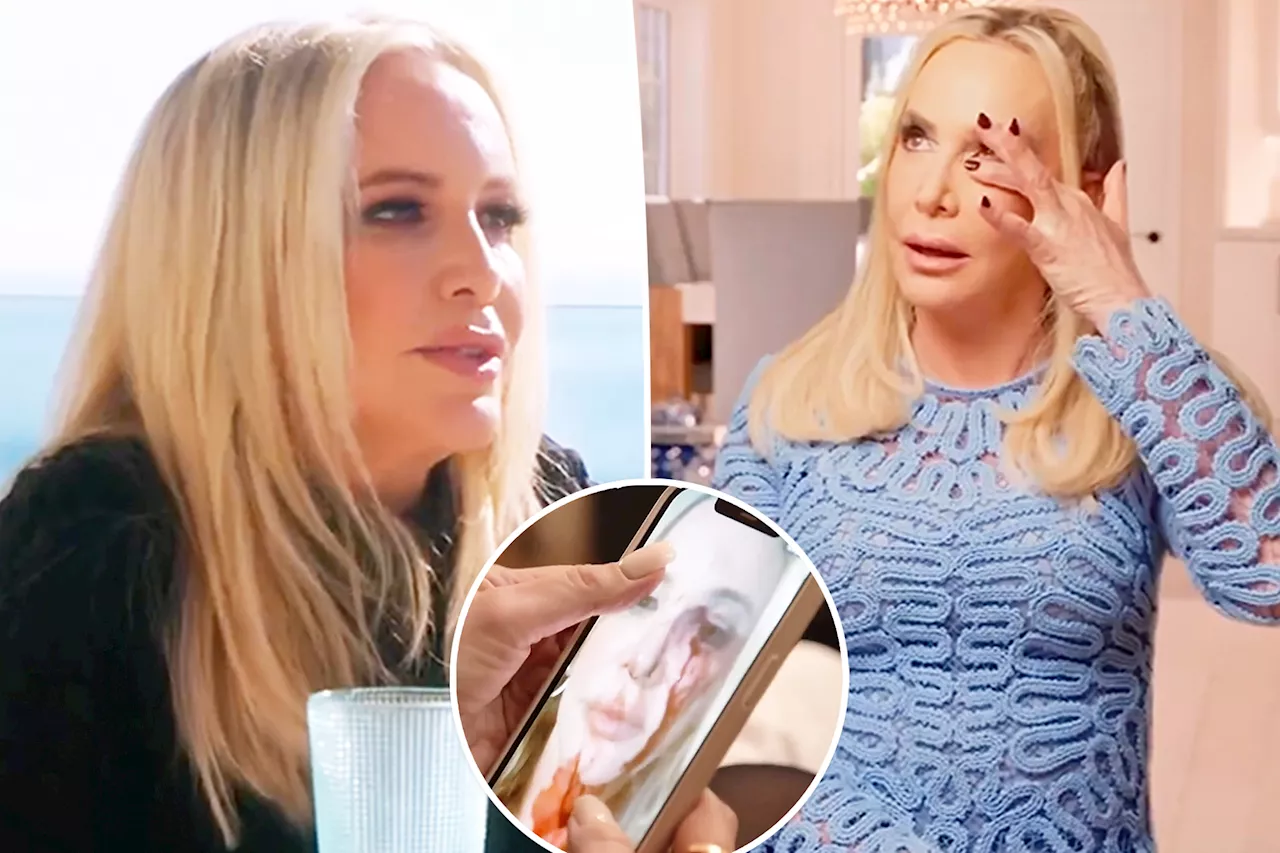 See shocking photo of Shannon Beador's bloodied face after DUI accident