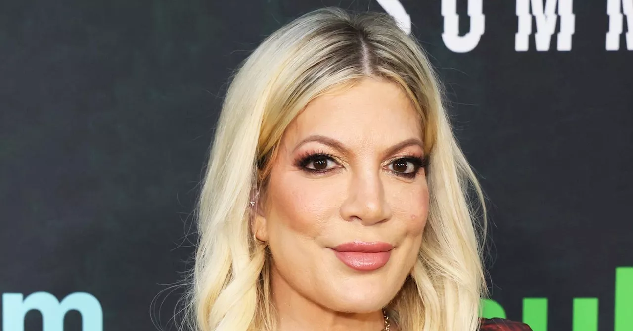 Tori Spelling On Why Her Smile ‘Zapped’ Her Confidence