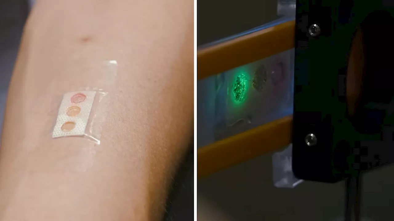 No finger pricks: Tiny laser-loaded band-aid tracks glucose from sweat