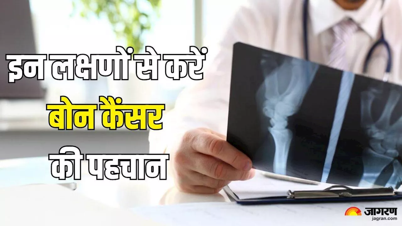 बेहद दुर्लभ लेकिन खतरनाक है Bone Cancer, डॉक्टर से बताए इसके लक्षण और इलाज के तरीके