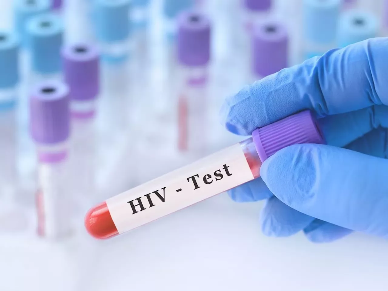 भारताच्या 'या' राज्यात 800 हून अधिक विद्यार्थी HIV पॉझिटिव्ह, 47 जणांचा मृत्यू... धक्कादायक कारण