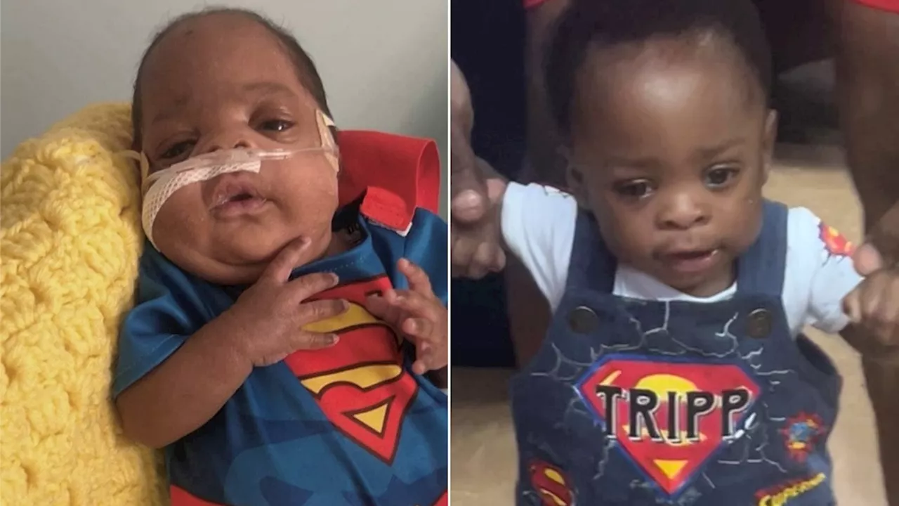 Baby born weighing less than 1 pound celebrates 1st birthday