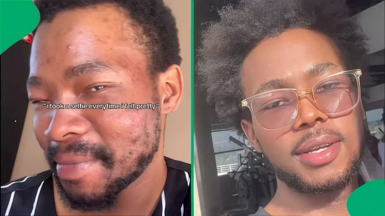 Mzansi Man's Incredible Skin Glow-Up Stuns South Africans, Shares Video