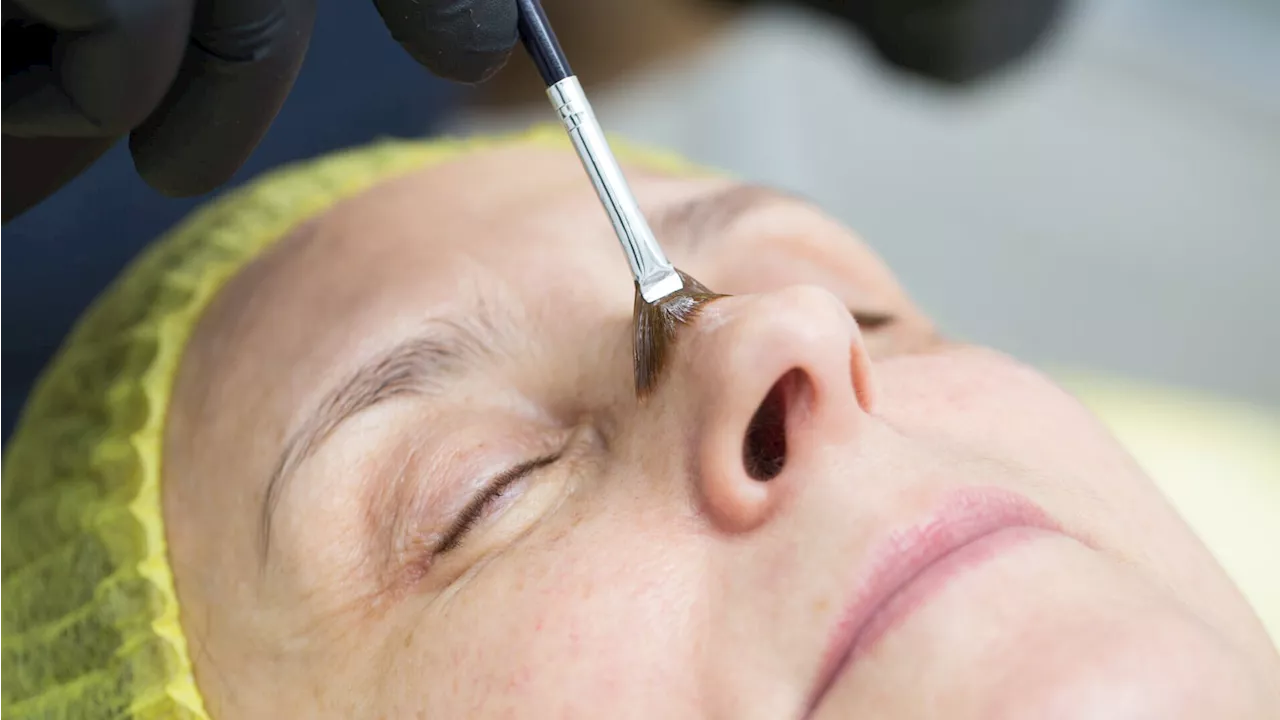 Stay Away From At-Home Chemical Peels, FDA Warns