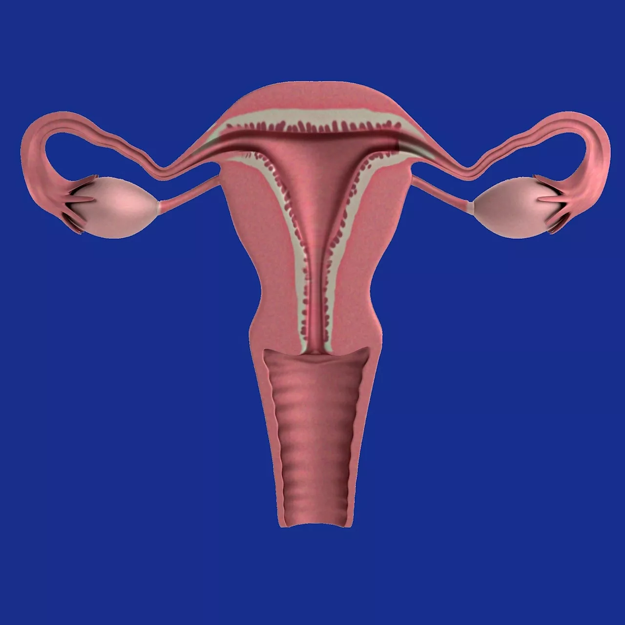 Treatment for recurrent uterine cancer advances to next research phase