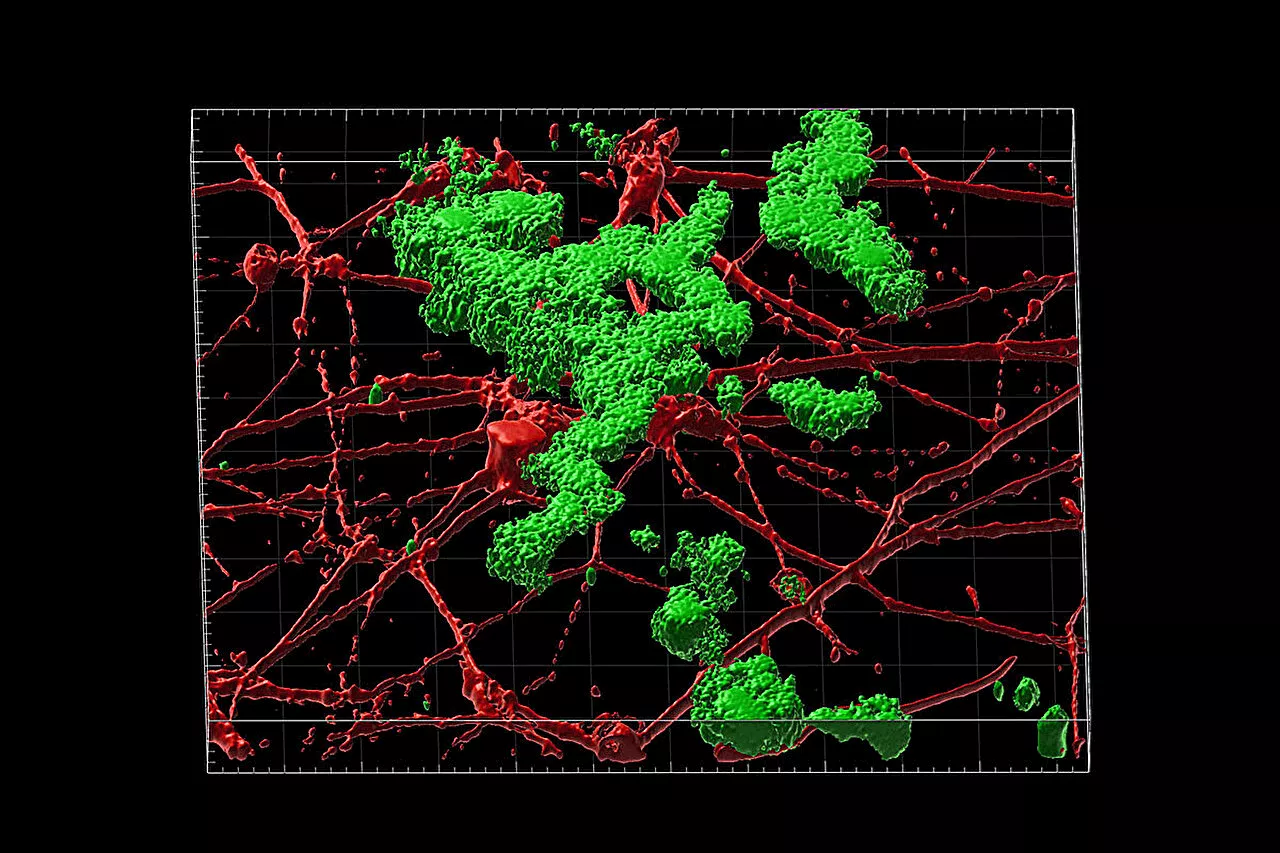 With new technique, patient-derived neurons accurately model late-onset Alzheimer's disease