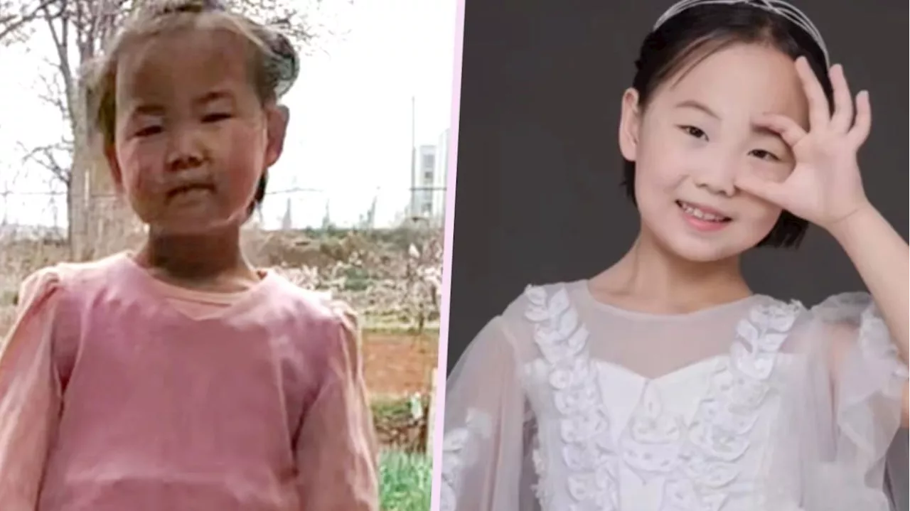 Stepmother’s unconditional love transforms lice-infected China girl into confident youngster, melting hearts online