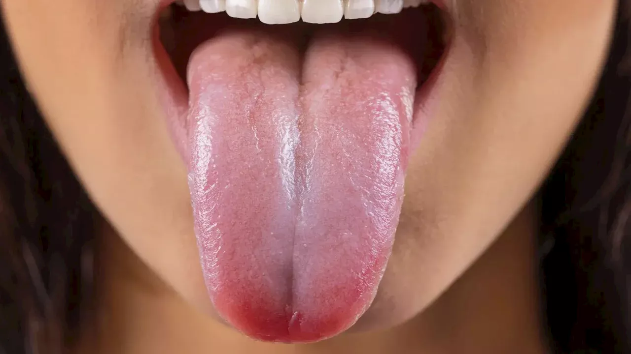 La lengua como indicador vital de salud: ¿qué nos dice este pequeño órgano sobre nuestro bienestar?