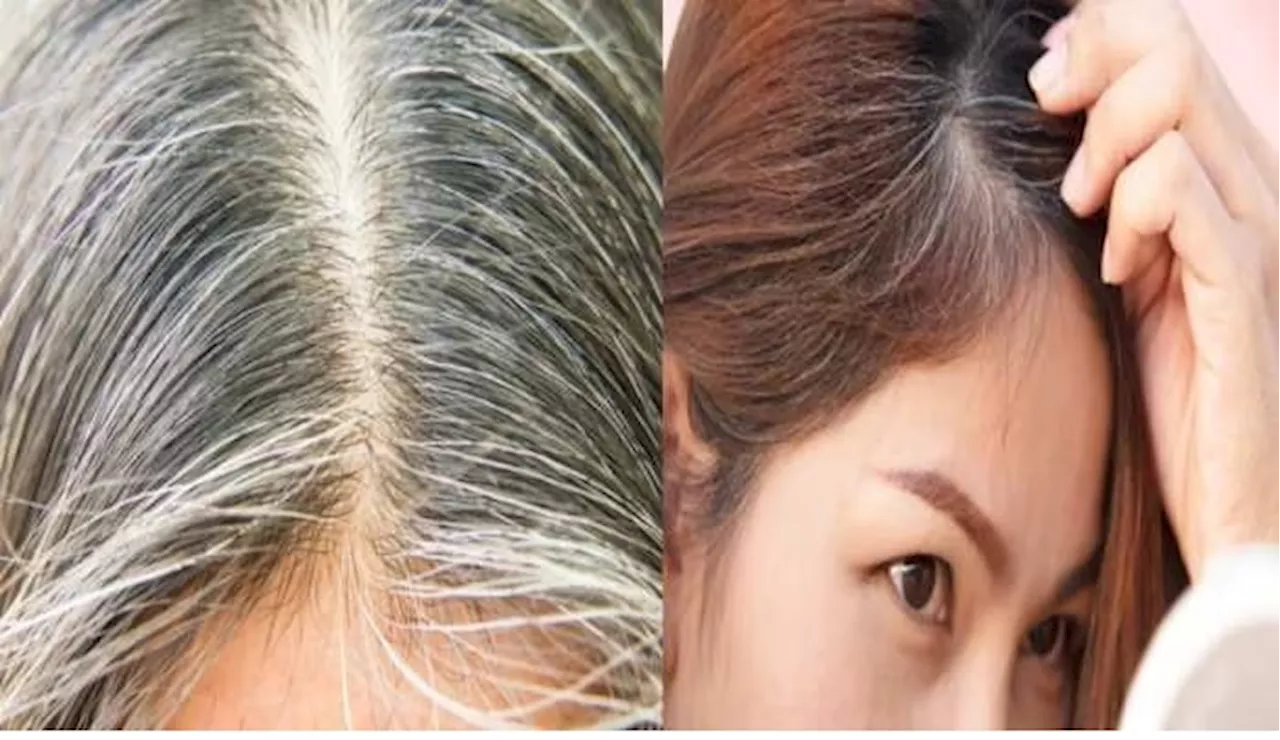 White Hair Problem: పెళ్లి కాకుండానే జుట్టు తెల్లబడటానికి కారణమేంటో తెలుసా, ఇలా చేస్తే చిటికెలో పరిష్కారం