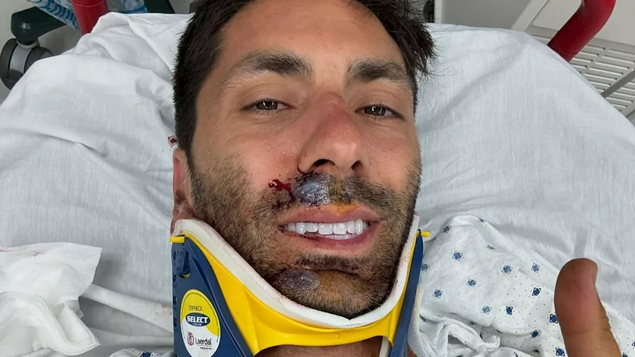 MTV-Moderator Nev Schulman bricht sich Genick: Horror-Unfall mit einem LKW