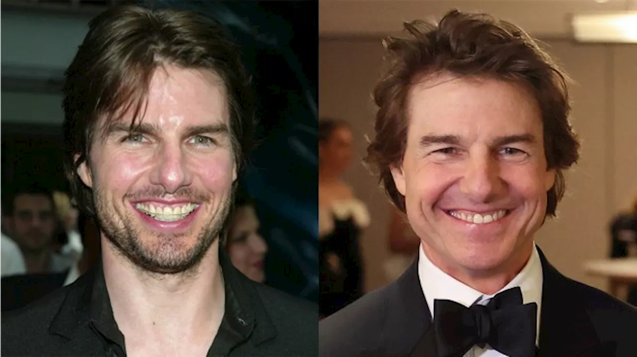 What Happened to Tom Cruise's Teeth?