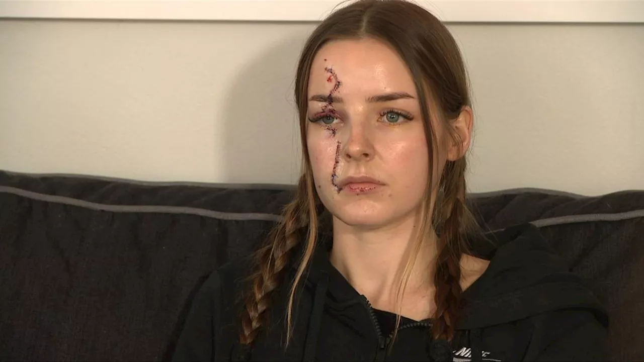 Victim of alleged glassing at Alkimos pub in Perth’s northern suburbs faces lengthy recovery